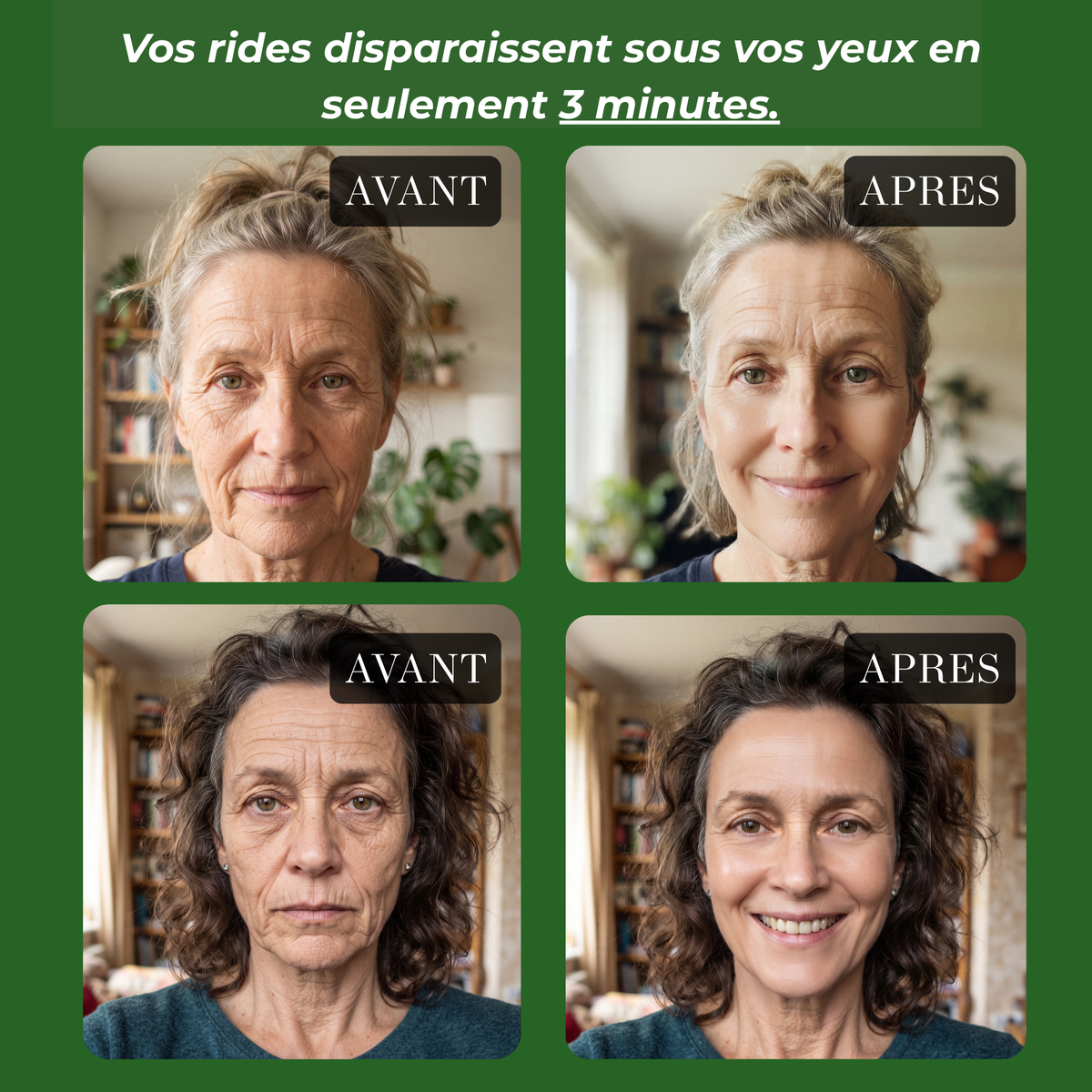 pack de 5 anti rides