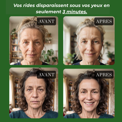 pack de 5 anti rides