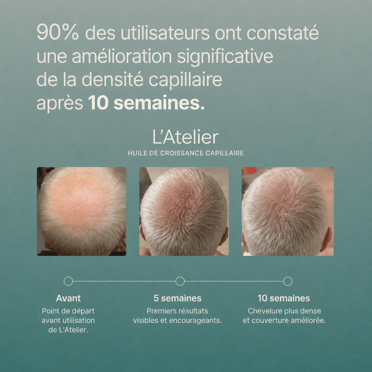Huile de repousse capillaire